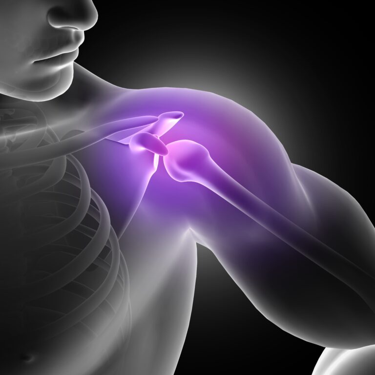 3d render male figure trying to prevent shoulder pain
